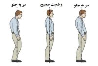 تمرینات اصلاحی برای رفع ناهنجاری «سر به جلو»