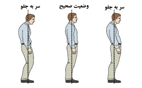 تمرینات اصلاحی برای رفع ناهنجاری «سر به جلو» تمرینات اصلاحی برای رفع ناهنجاری «سر به جلو»